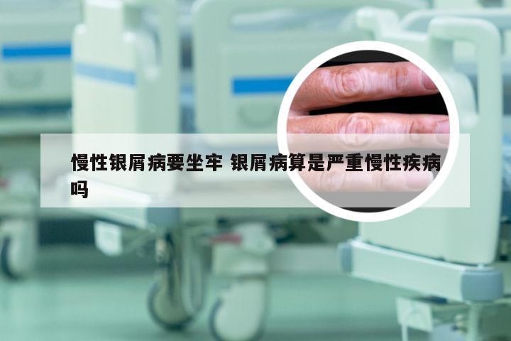 慢性银屑病要坐牢 银屑病算是严重慢性疾病吗