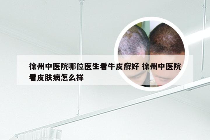 徐州中医院哪位医生看牛皮癣好 徐州中医院看皮肤病怎么样