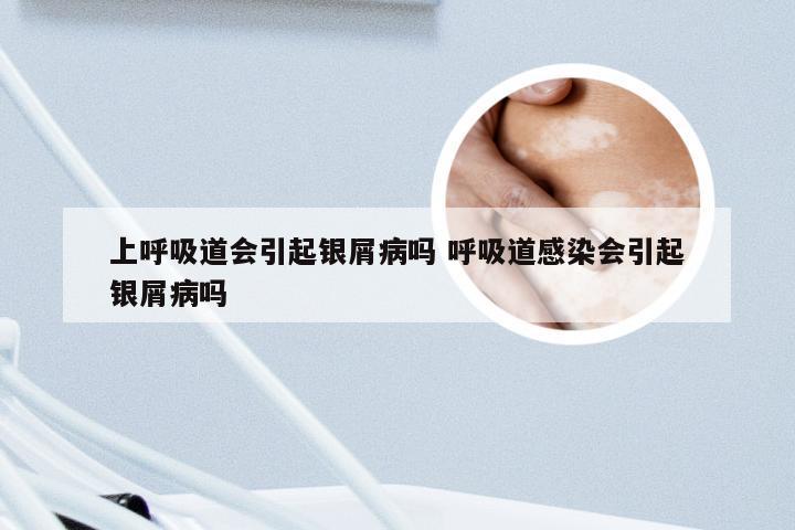 上呼吸道会引起银屑病吗 呼吸道感染会引起银屑病吗