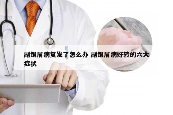 副银屑病复发了怎么办 副银屑病好转的六大症状