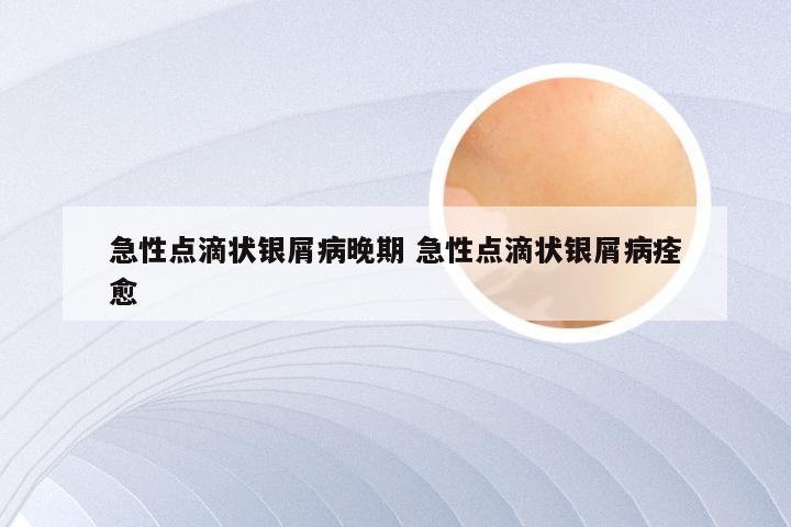 急性点滴状银屑病晚期 急性点滴状银屑病痊愈