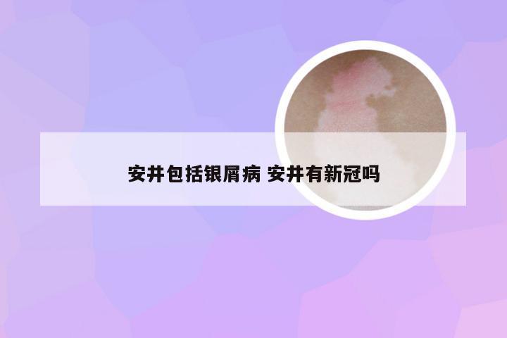 安井包括银屑病 安井有新冠吗
