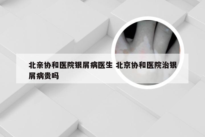 北亲协和医院银屑病医生 北京协和医院治银屑病贵吗