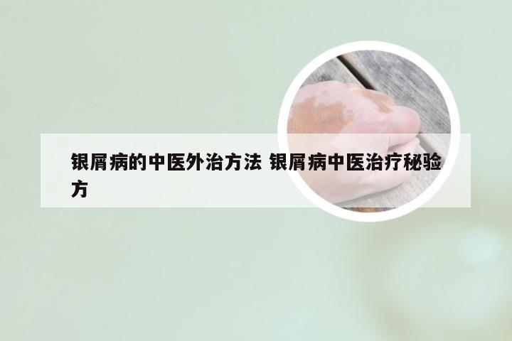 银屑病的中医外治方法 银屑病中医治疗秘验方