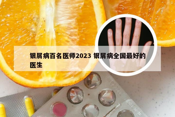 银屑病百名医师2023 银屑病全国最好的医生