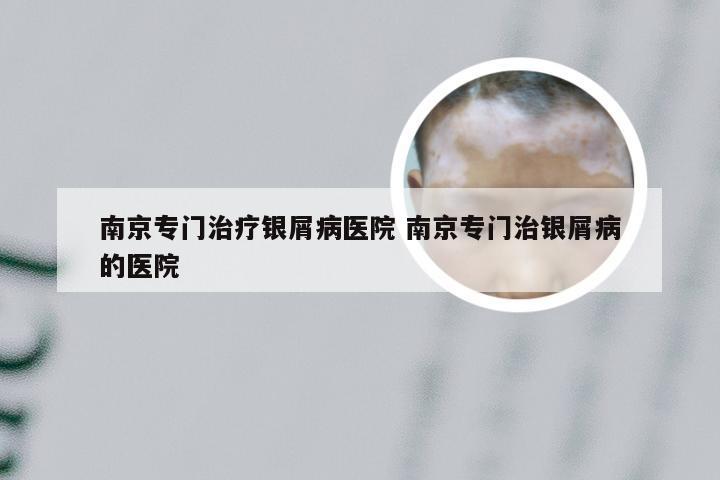 南京专门治疗银屑病医院 南京专门治银屑病的医院