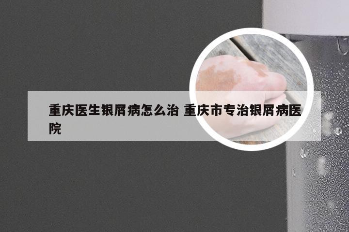 重庆医生银屑病怎么治 重庆市专治银屑病医院