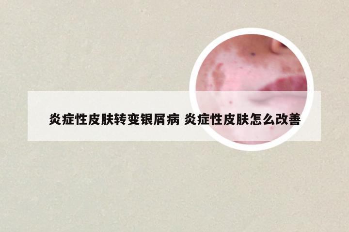 炎症性皮肤转变银屑病 炎症性皮肤怎么改善