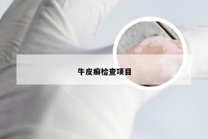 牛皮癣检查项目