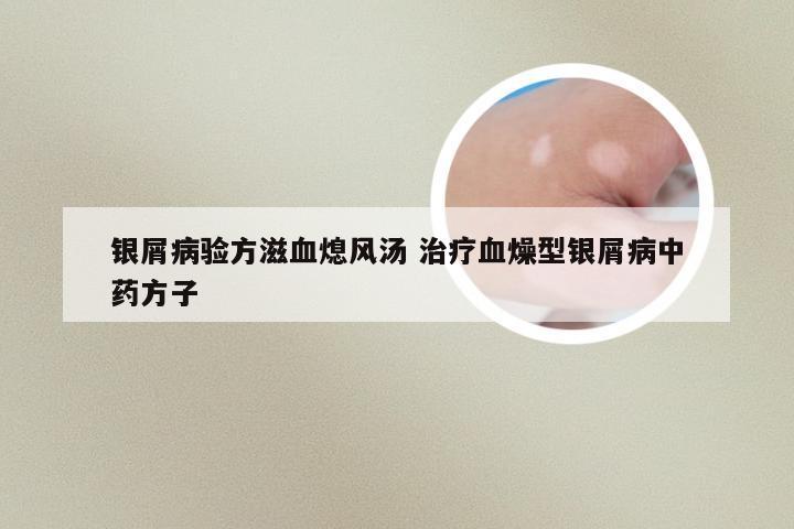 银屑病验方滋血熄风汤 治疗血燥型银屑病中药方子