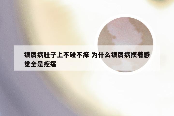 银屑病肚子上不碰不痒 为什么银屑病摸着感觉全是疙瘩