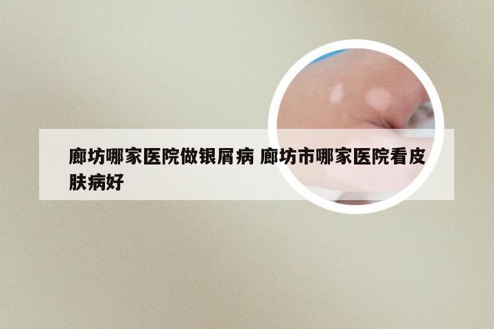 廊坊哪家医院做银屑病 廊坊市哪家医院看皮肤病好