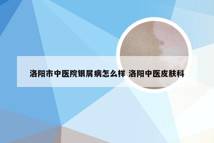 洛阳市中医院银屑病怎么样 洛阳中医皮肤科