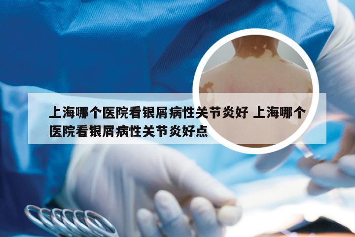 上海哪个医院看银屑病性关节炎好 上海哪个医院看银屑病性关节炎好点