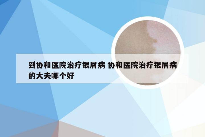 到协和医院治疗银屑病 协和医院治疗银屑病的大夫哪个好