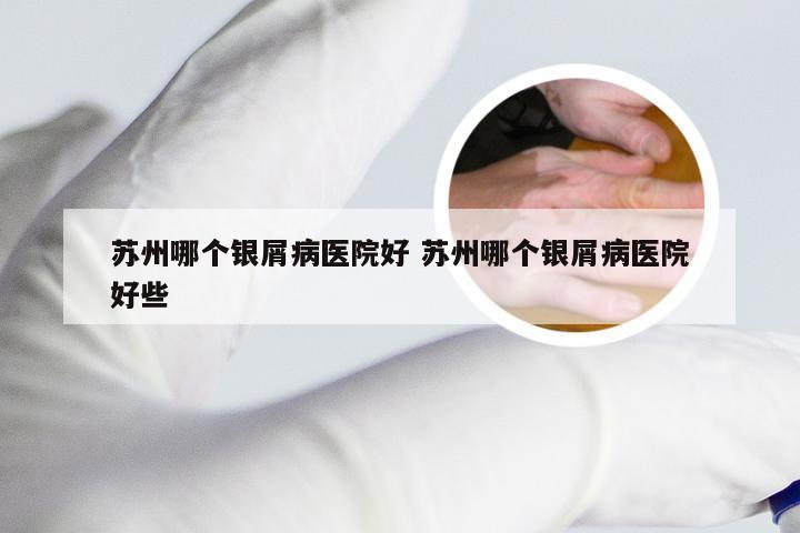 苏州哪个银屑病医院好 苏州哪个银屑病医院好些