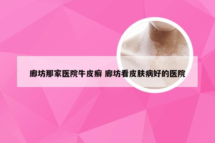 廊坊那家医院牛皮癣 廊坊看皮肤病好的医院