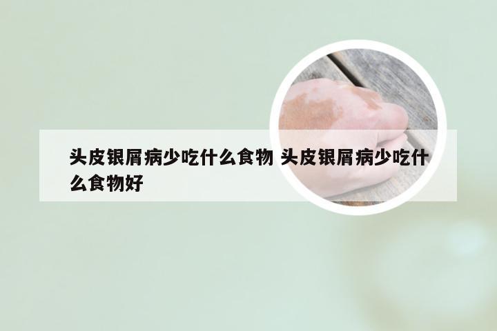 头皮银屑病少吃什么食物 头皮银屑病少吃什么食物好