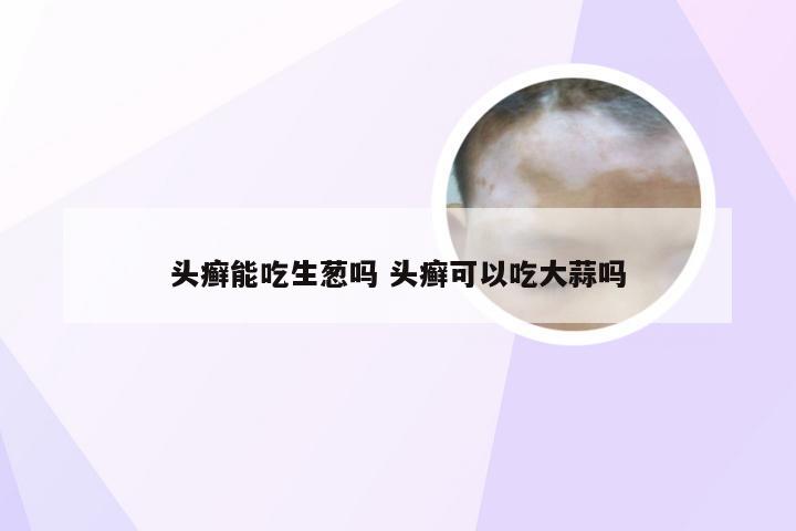 头癣能吃生葱吗 头癣可以吃大蒜吗