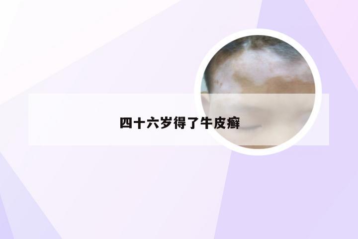 四十六岁得了牛皮癣