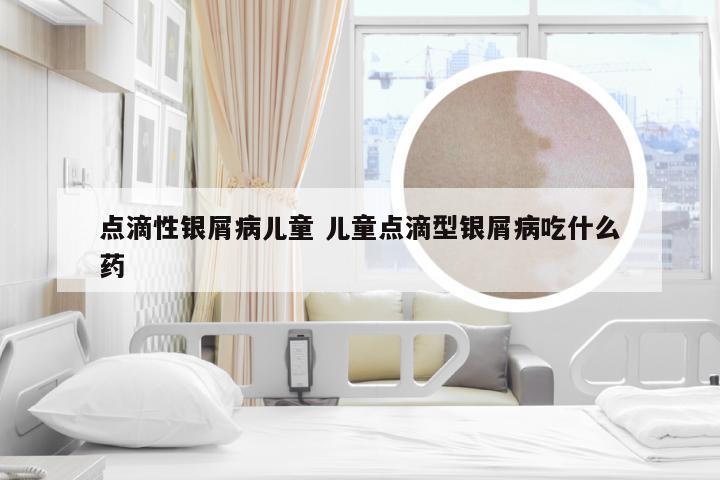 点滴性银屑病儿童 儿童点滴型银屑病吃什么药