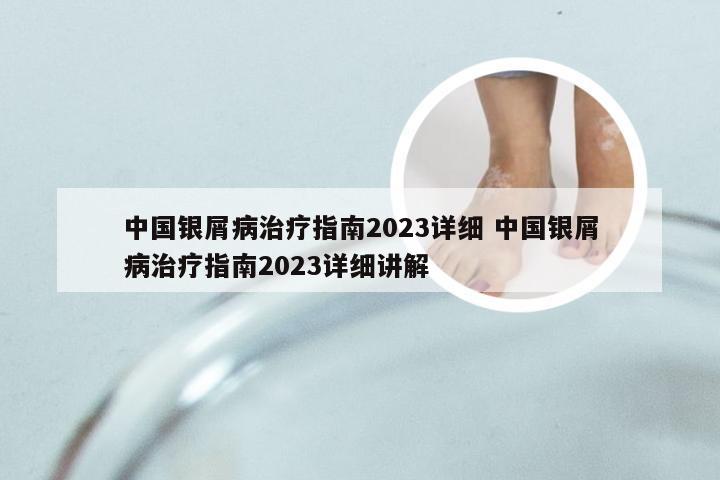 中国银屑病治疗指南2023详细 中国银屑病治疗指南2023详细讲解