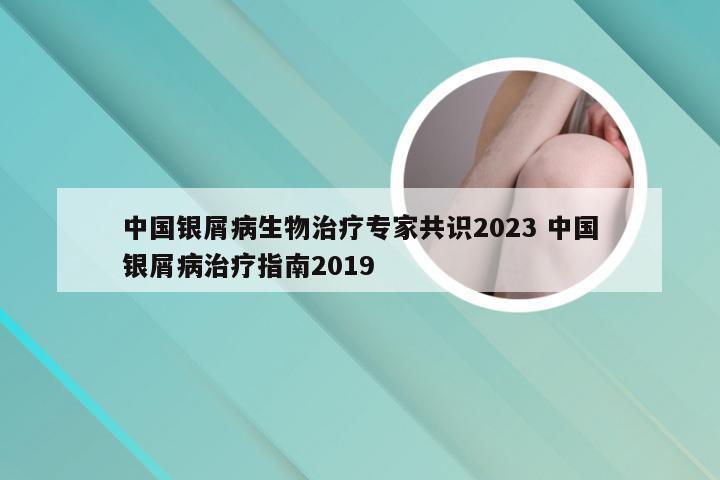 中国银屑病生物治疗专家共识2023 中国银屑病治疗指南2019