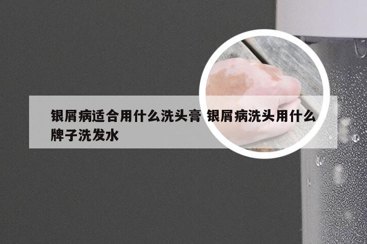 银屑病适合用什么洗头膏 银屑病洗头用什么牌子洗发水