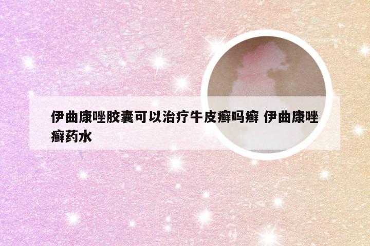 伊曲康唑胶囊可以治疗牛皮癣吗癣 伊曲康唑癣药水