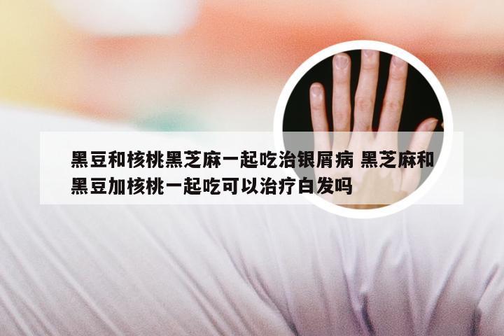 黑豆和核桃黑芝麻一起吃治银屑病 黑芝麻和黑豆加核桃一起吃可以治疗白发吗