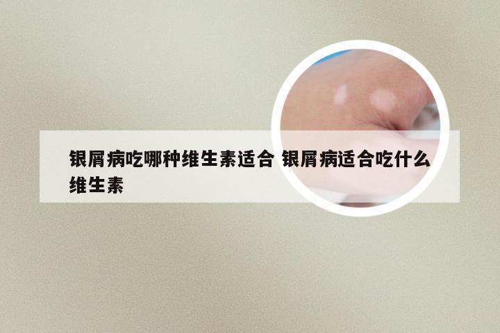 银屑病吃哪种维生素适合 银屑病适合吃什么维生素
