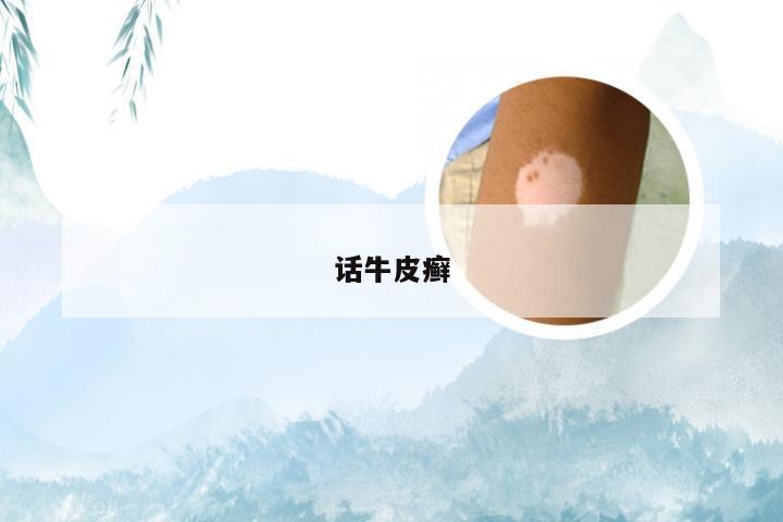 话牛皮癣
