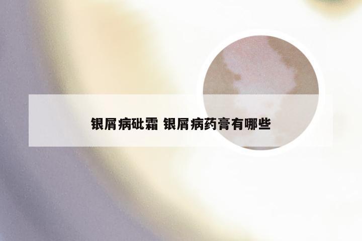 银屑病砒霜 银屑病药膏有哪些