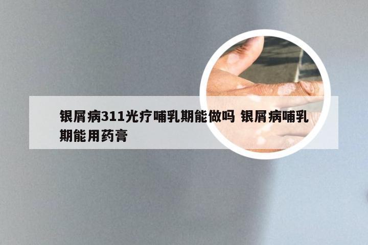 银屑病311光疗哺乳期能做吗 银屑病哺乳期能用药膏