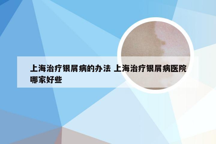 上海治疗银屑病的办法 上海治疗银屑病医院哪家好些