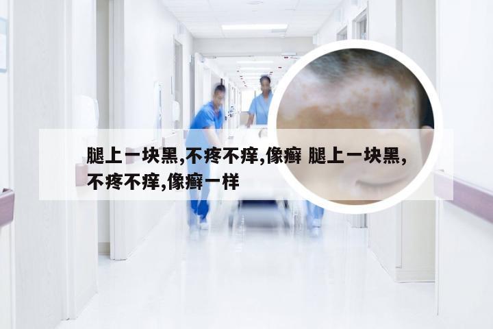 腿上一块黑,不疼不痒,像癣 腿上一块黑,不疼不痒,像癣一样