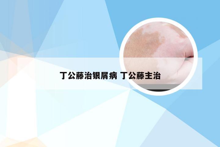 丁公藤治银屑病 丁公藤主治