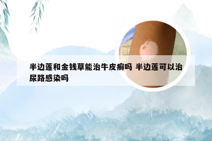 半边莲和金钱草能治牛皮癣吗 半边莲可以治尿路感染吗