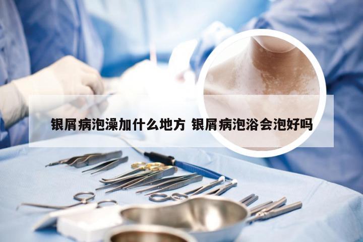 银屑病泡澡加什么地方 银屑病泡浴会泡好吗