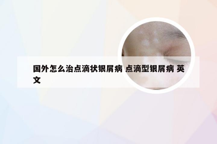 国外怎么治点滴状银屑病 点滴型银屑病 英文