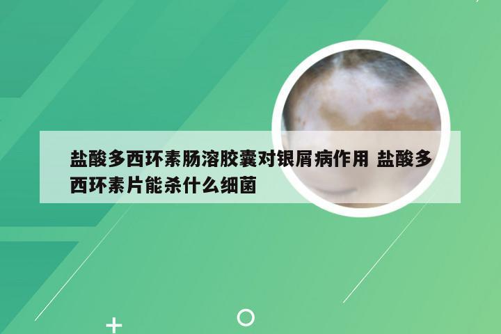 盐酸多西环素肠溶胶囊对银屑病作用 盐酸多西环素片能杀什么细菌