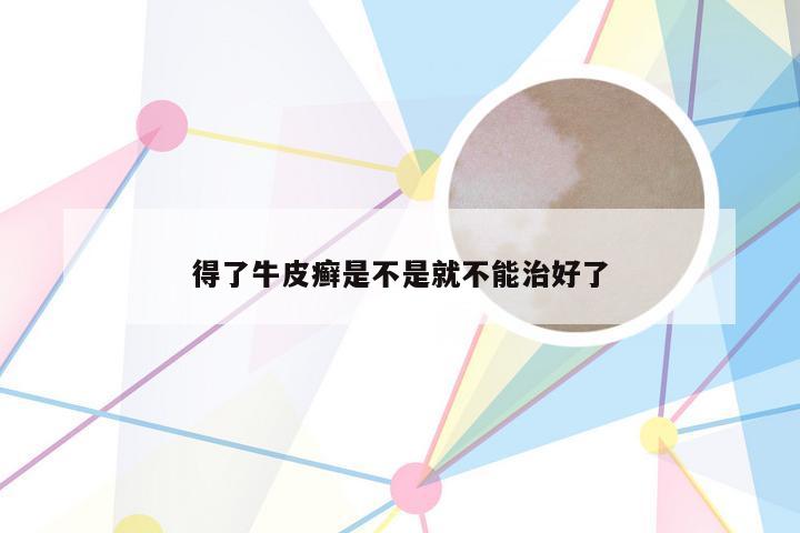 得了牛皮癣是不是就不能治好了
