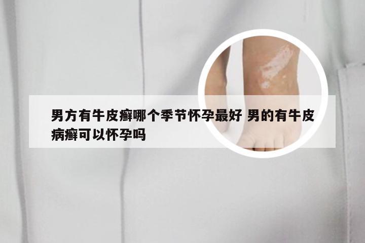 男方有牛皮癣哪个季节怀孕最好 男的有牛皮病癣可以怀孕吗