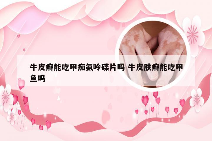 牛皮癣能吃甲痴氨呤碟片吗 牛皮肤癣能吃甲鱼吗