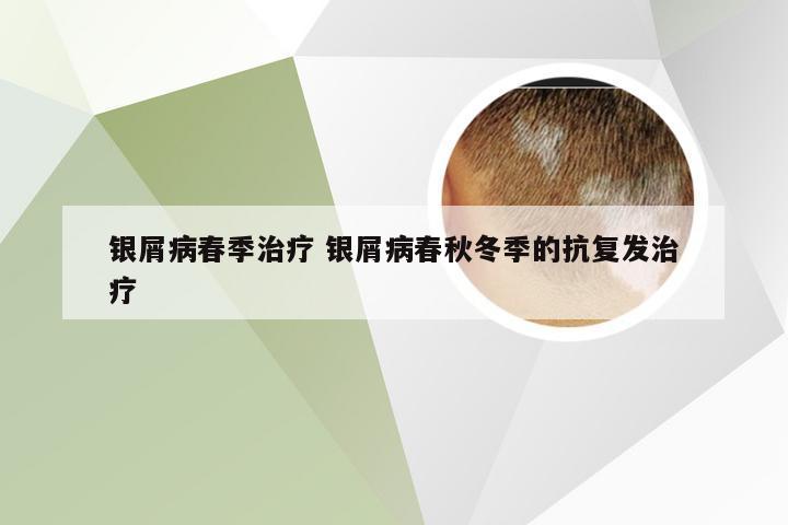 银屑病春季治疗 银屑病春秋冬季的抗复发治疗