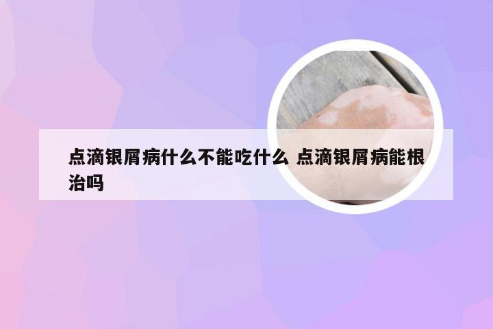 点滴银屑病什么不能吃什么 点滴银屑病能根治吗