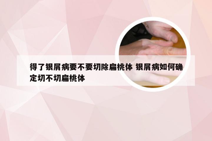 得了银屑病要不要切除扁桃体 银屑病如何确定切不切扁桃体