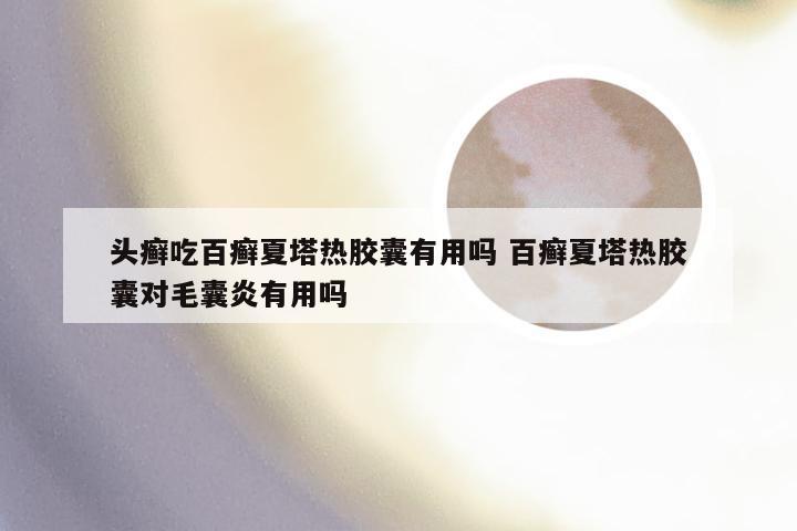 头癣吃百癣夏塔热胶囊有用吗 百癣夏塔热胶囊对毛囊炎有用吗