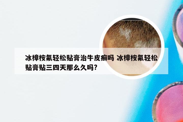 冰樟桉氟轻松贴膏治牛皮癣吗 冰樟桉氟轻松贴膏贴三四天那么久吗?