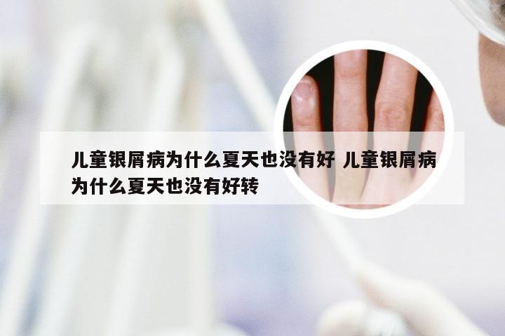 儿童银屑病为什么夏天也没有好 儿童银屑病为什么夏天也没有好转